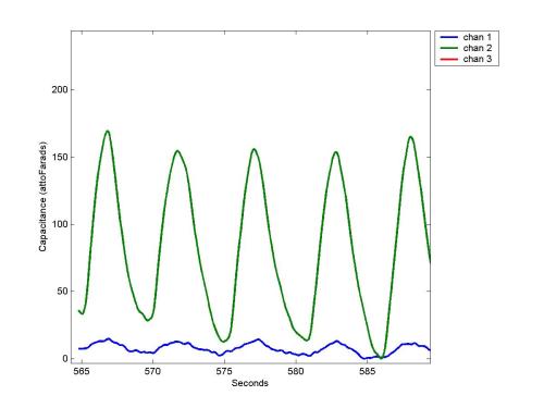 Breathing detection